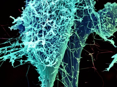 The string-like Ebola virus. Credit: Heinz Feldmann, Peter Jahrling, Elizabeth Fischer and Anita Mora, National Institute of Allergy and Infectious Diseases, National Institutes of Health.